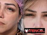 🔥 ¡CAMBIA TU ROSTRO, ELEVA TU BELLEZA HOY! 🔥 ¿Lista para verte más joven, radiante y segura desde la primera sesión?
