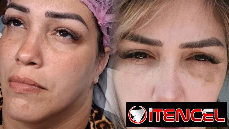 🔥 ¡CAMBIA TU ROSTRO, ELEVA TU BELLEZA HOY! 🔥 ¿Lista para verte más joven, radiante y segura desde la primera sesión?