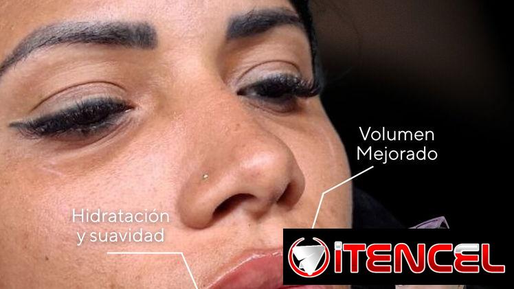 💉 Descubre el poder de la técnica de 4 puntos con ácido hialurónico y el aumento de labios en Spa Leydis Marianao 🌸