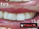 ¿Deseas una sonrisa brillante?