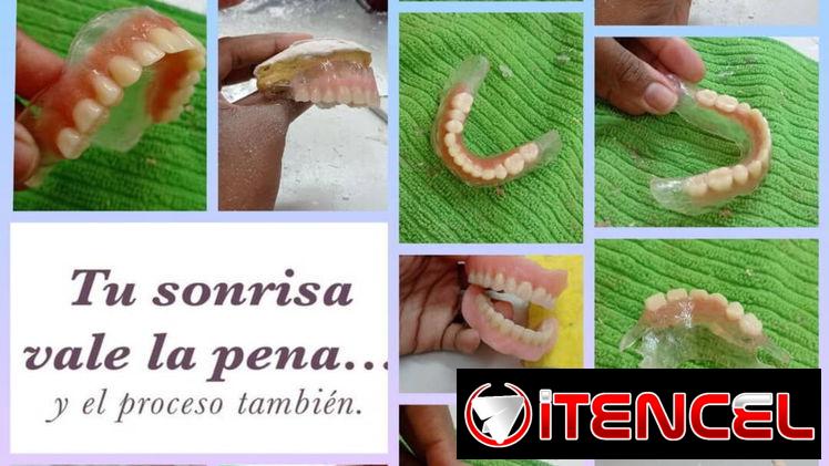 Transforma tu sonrisa Protesis y aparatos dentales