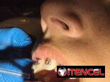 Servicios Dentales / Ortodoncia /Carillas/Prótesis