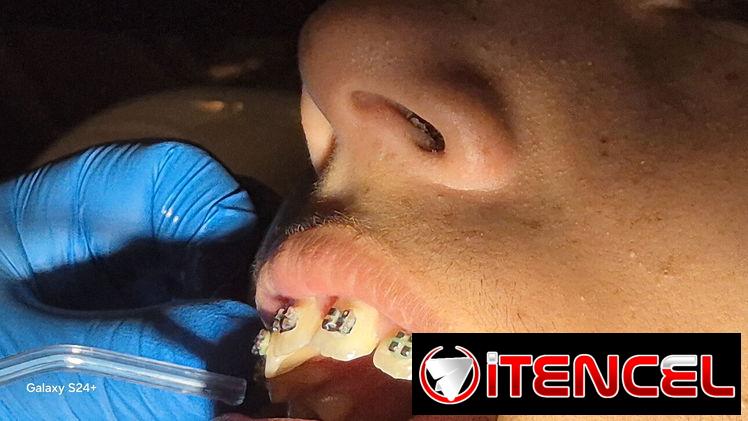 Servicios Dentales / Ortodoncia /Carillas/Prótesis
