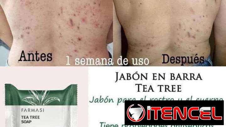 El Jabón de Árbol de Té de Farmasi elimina suavemente la suciedad y el exceso de grasa sin resecar la piel. Puede utiliz