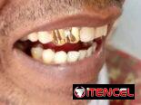 ✨🪙 J&A Sonríe con estilo✨, Brilla con oro✨tenemos oferta especial 😃 x el día de los padres 🤩  Realizo todo tipo de tr