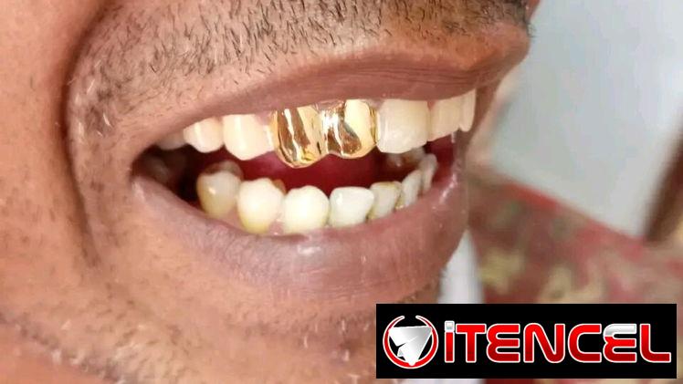 ✨🪙 J&A Sonríe con estilo✨, Brilla con oro✨tenemos oferta especial 😃 x el día de los padres 🤩  Realizo todo tipo de tr