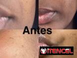 Crema quita manchas Carotone Original