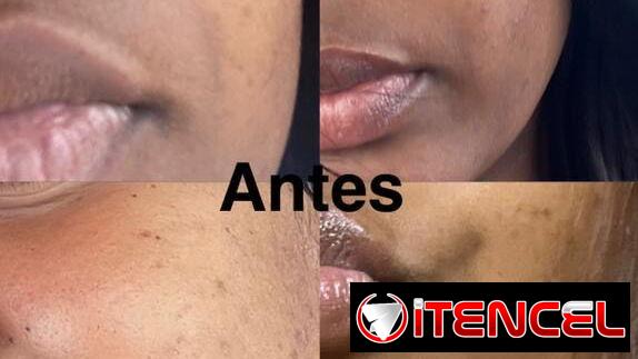 Crema quita manchas Carotone Original