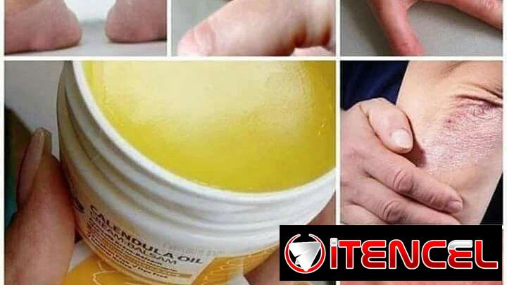 ¿Piel irritada o quemada? Necesitas este Bálsamo en casa