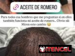 Aceite de romero de la Influencer Amanda Camaraza
