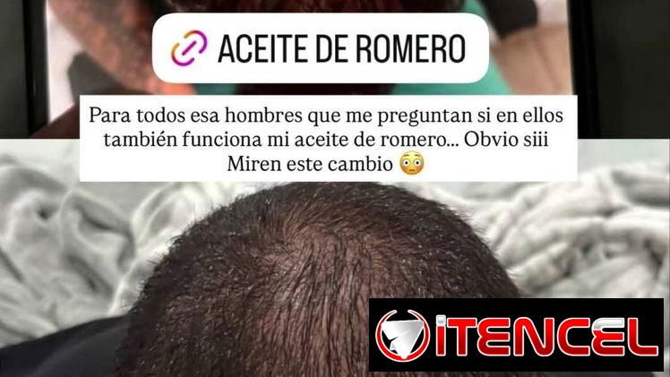 Aceite de romero de la Influencer Amanda Camaraza