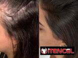Combo Reviving Farmasi – fuerza y crecimiento capilar