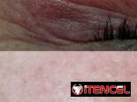 Limpieza Facial | Hidratación | Tratamiento para manchas, acné, lineas de expresión. .
