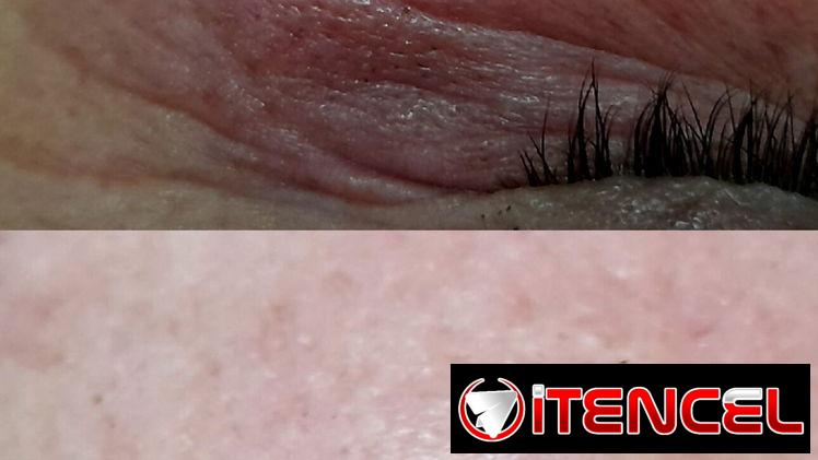 Limpieza Facial | Hidratación | Tratamiento para manchas, acné, lineas de expresión. .