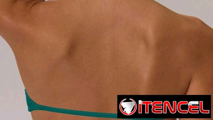 Top musera