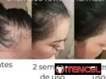 Combo Reviving Farmasi – fuerza y crecimiento capilar