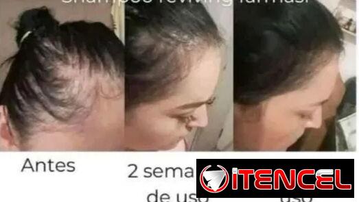 Combo Reviving Farmasi – fuerza y crecimiento capilar