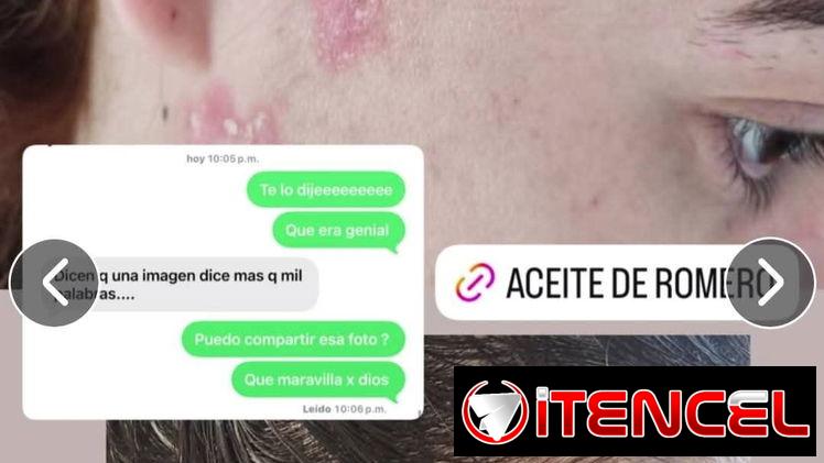 Aceite de romero de la Influencer Amanda Camaraza