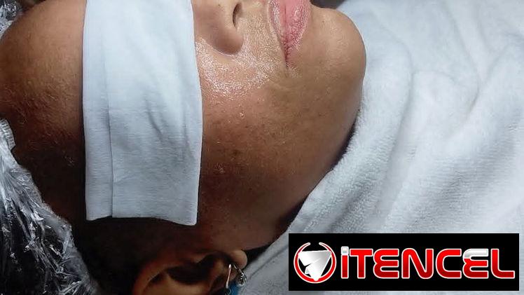Limpieza facial profunda con Aparatologia