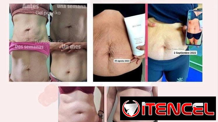 🔥Gel reductor que todos necesitamos 🔥