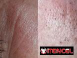 LIMPIEZA FACIAL| MASAJE RELAJANTE _ TERAPIAS CORPORALES | PODO TERAPIA