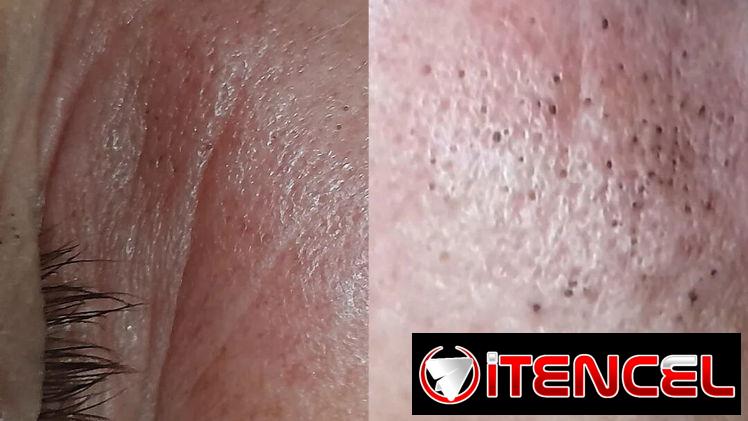 LIMPIEZA FACIAL| MASAJE RELAJANTE _ TERAPIAS CORPORALES | PODO TERAPIA