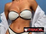 💯Bikinis baratos. Todo lindo