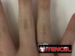 ANILLOS