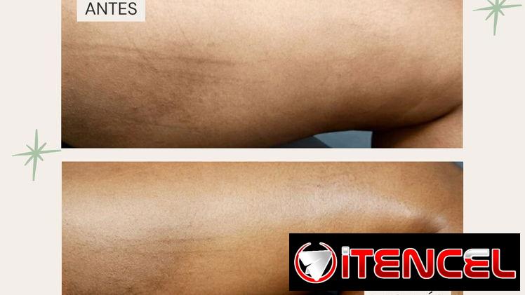 OFERTAS DE VERANO EN SPA_LEYDIS . MARIANAO. CAMBIOS DESDE LA 1RA SESIÓN.