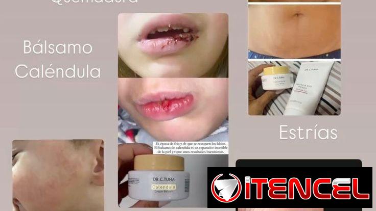 Elimina cicatrices dermatitis psoriasis cortaduras estarías picaduras ezcemas rosácea
