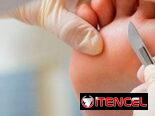 Servicio de podología a domicilio.