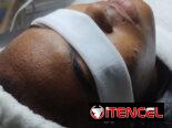 Limpieza facial profunda con Aparatologia