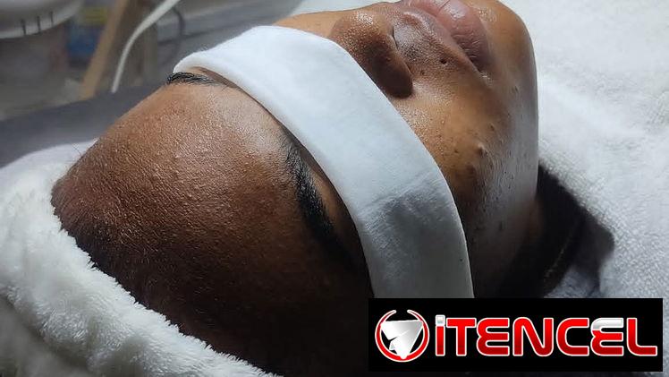 Limpieza facial profunda con Aparatologia