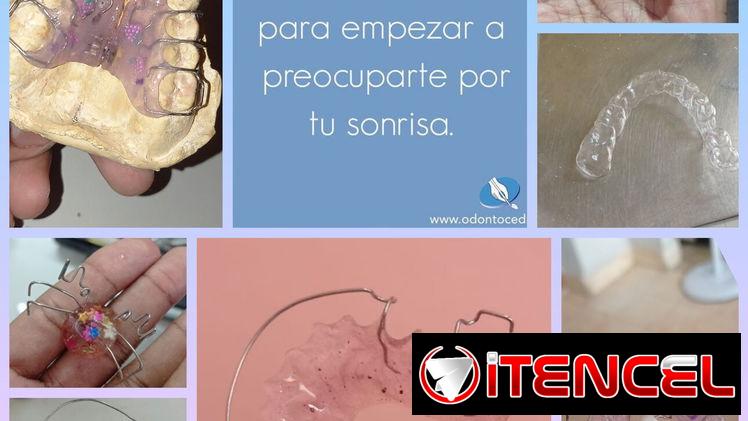 Ortodoncia removible