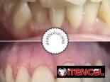 Servicios Dentales / Ortodoncia /Carillas/Prótesis