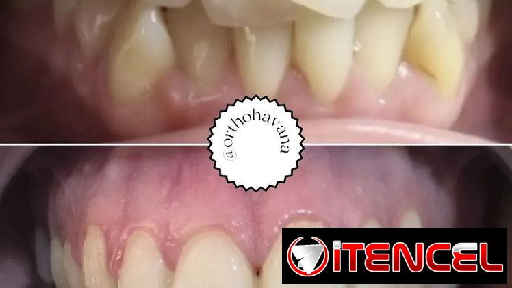Servicios Dentales / Ortodoncia /Carillas/Prótesis