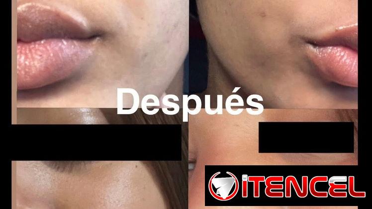 Crema quita manchas Carotone Original