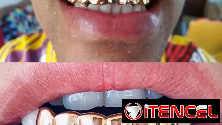 ✨🪙 J&A Sonríe con estilo✨, Brilla con oro✨tenemos oferta especial 😃 x el día de los padres 🤩  Realizo todo tipo de tr