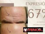 ‼️ BOTOX INSTANTÁNEO Farmasi‼️😍
