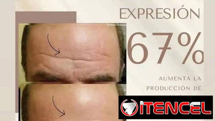 ‼️ BOTOX INSTANTÁNEO Farmasi‼️😍