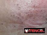 Masajes / limpieza de Espalda/ limpieza facial profunda / pedicura hidratante