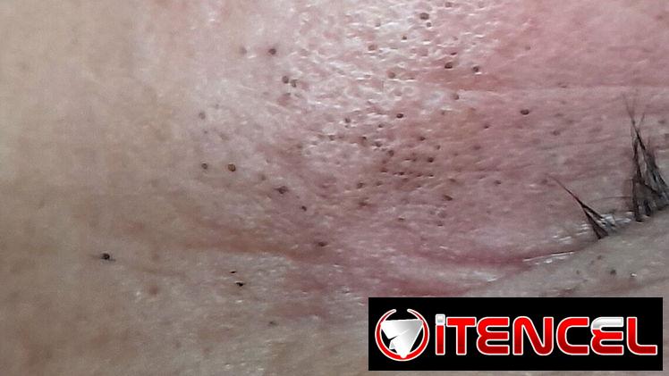 Masajes / limpieza de Espalda/ limpieza facial profunda / pedicura hidratante