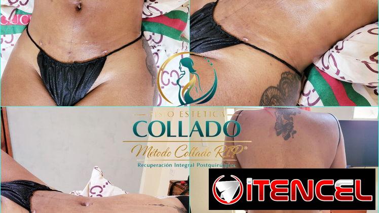 ✅ DRENAJE LINFÁTICO POST QUIRÚRGICO MASAJES POST OPERATORIO APARATOLOGIA ASESORÍA DOMICILIO GRATIS