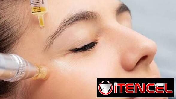 PRP Facial. Medicina Estética para tu eterna juventud — foto 3