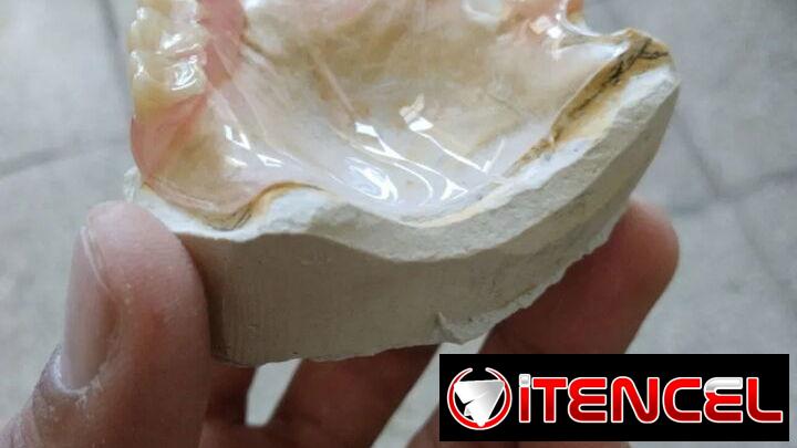 Se reparan y se conferciona prótesis — foto 3