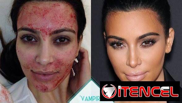 PRP Facial. Medicina Estética para tu eterna juventud — foto 1