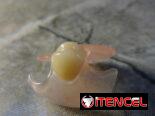 Laboratorio dental