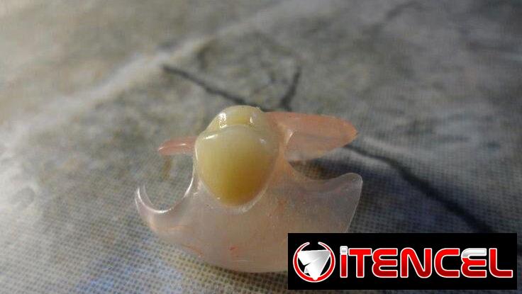 Laboratorio dental