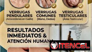 Eliminación de verrugas comunes y vulgares