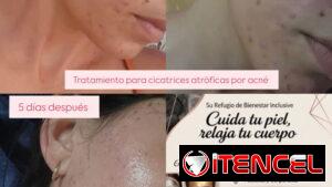Tratamientos faciales y corporales, tu bienestar es mi prioridad